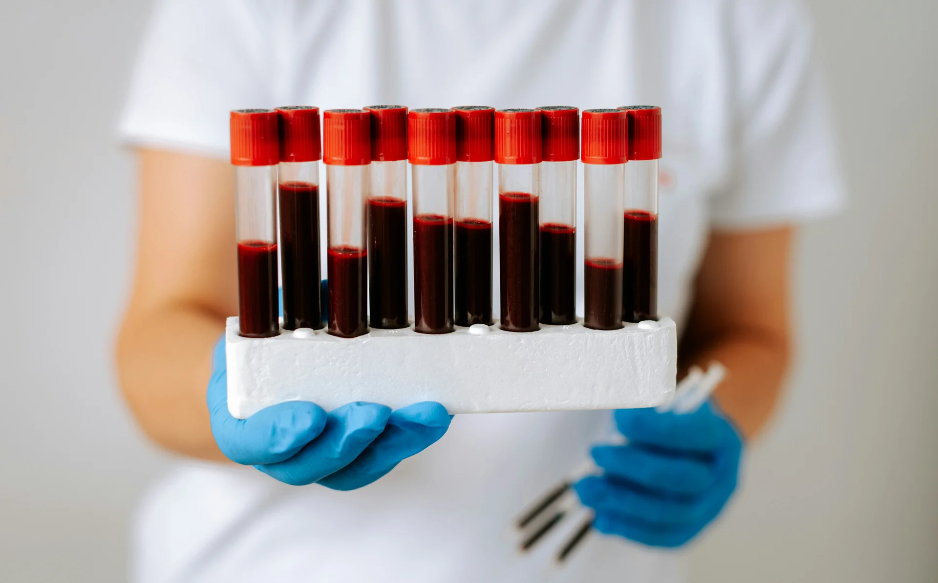 Functional medicine lab testing blood analysis