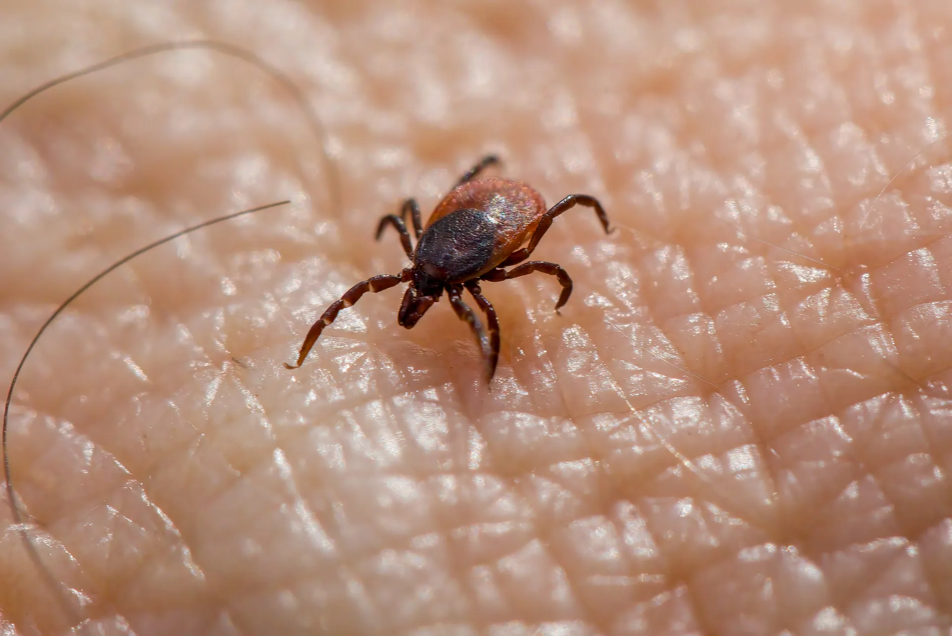 Lyme disease integrative treatment functional medicine